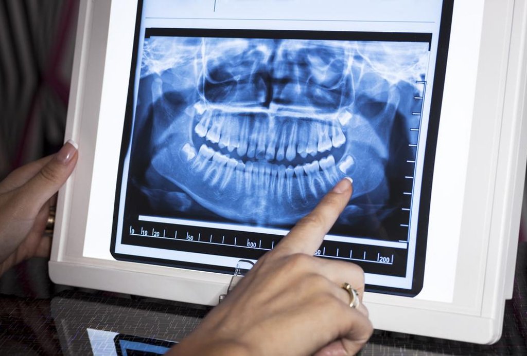 Digital dental X-ray in Bhubaneswar at Pathak Dental Clinic