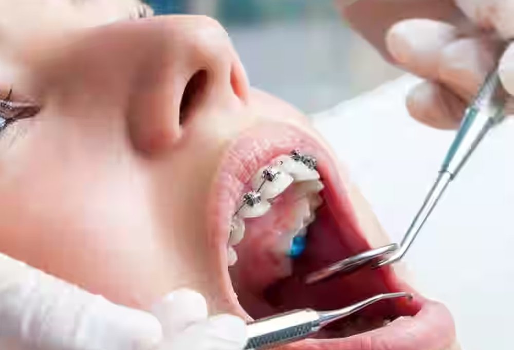 Full Mouth Rehabilitation