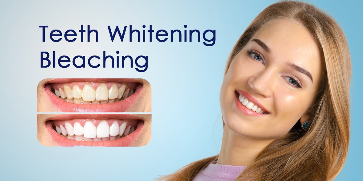 Teeth Whitening & Bleaching in Bhubaneswar | Pathak Dental Clinic