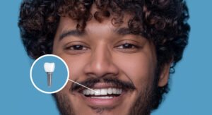 Read more about the article Dental Implants in Bhubaneswar – Permanent Solution for Missing Teeth
