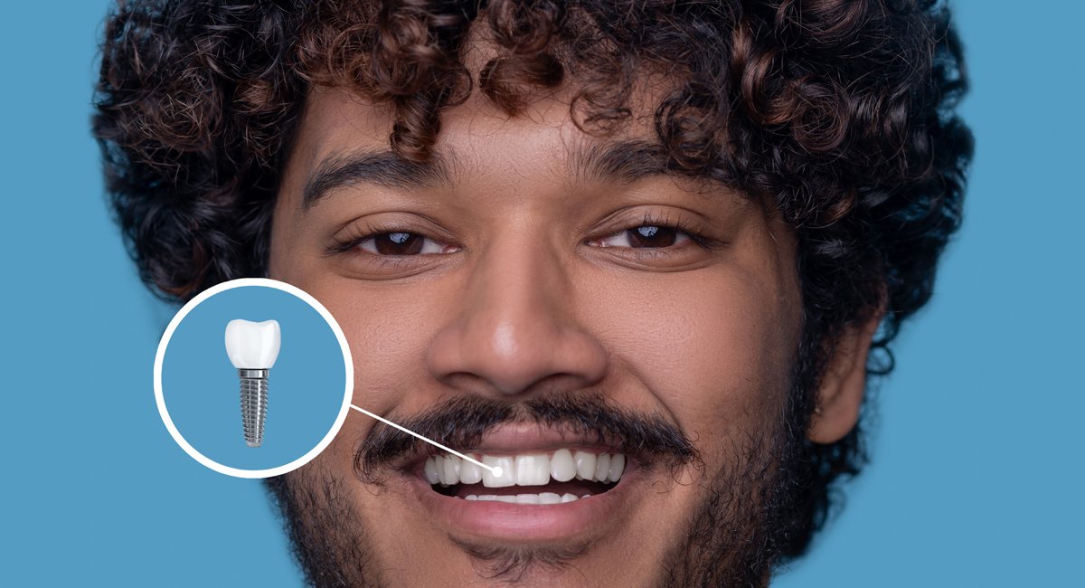 Dental Implants in Bhubaneswar – Permanent Solution for Missing Teeth