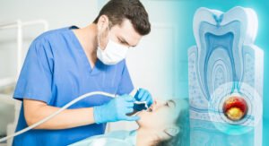 Read more about the article Root Canal Treatment in Bhubaneswar – Safe & Painless Tooth Saving Procedure